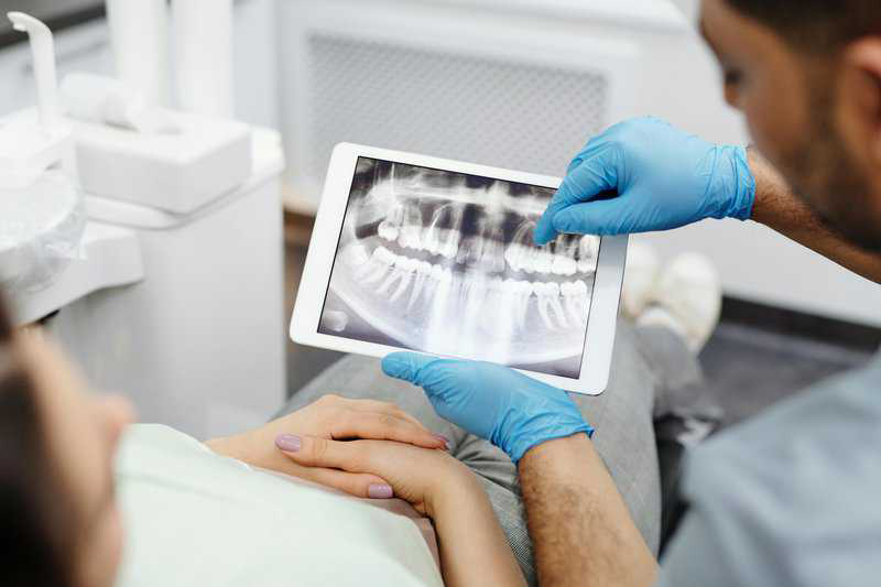 7 Signs You Need a Dental Crown