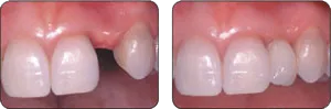 ba_cases_st1