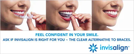 Invisalign-Confidence_01