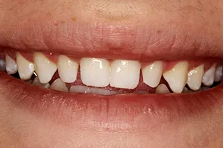 case-new-10-before