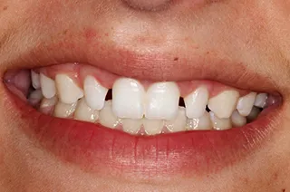case-new-12-before