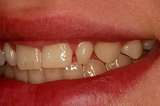 case-new-16-before