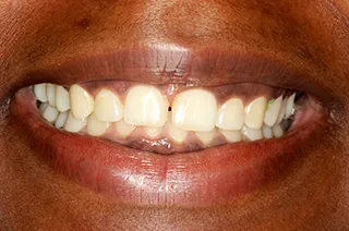 case-new-19-before