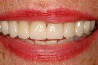 case-new-22-after