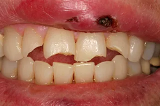 case-new-22-before